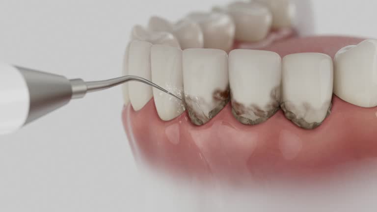 Reliable Dental Implants contractor in Chase, PA by Smile Center Dentistry